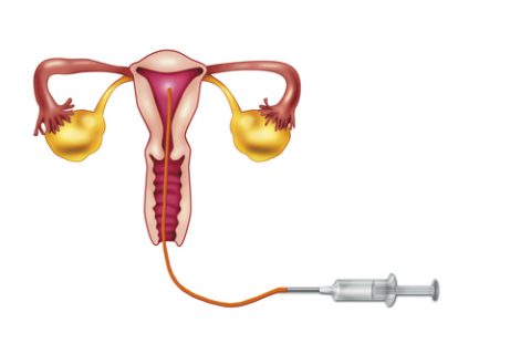 inseminacja